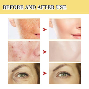 Anti-aging Fade Fine Lines Repairing Essence Serum